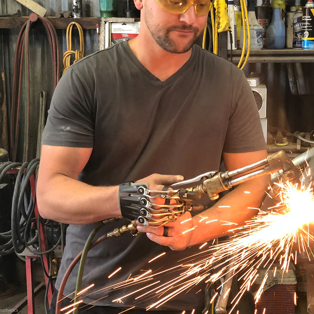 Naked Prosthetics Body-Driven Devices: Innovative Tech for Digit Amputees