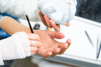 Silicone hand prosthesis being sculpted A close up of a silicone hand prosthesis with a white skin tone being sculpted by a technician next to hand cast