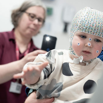 Starband Cranial Remoulding Assessment London Prosthetics