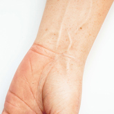Close up of Silicone hand and upper arm prosthesis wrist with veins with a white skin tone