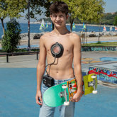 What Is Pectus Excavatum Steeper Clinic