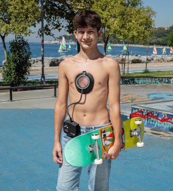 What Is Pectus Excavatum Steeper Clinic What Is Pectus Excavatum Steeper Clinic