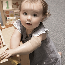 Toddler Paediatric Prosthetics A toddler with a prosthetic left arm leaning on a table playing with a wooden puzzle