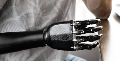 Upper Limb Espire Header Image LPC Website 1 Upper Limb Espire Header Image LPC Website 1