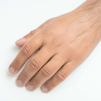 Close up of Silicone hand prosthesis